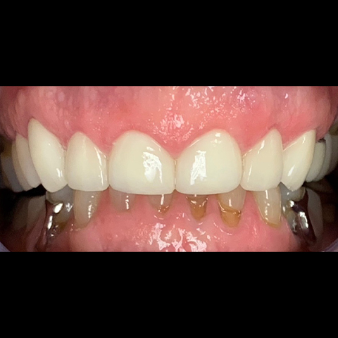 Healthy smile after dental treatment