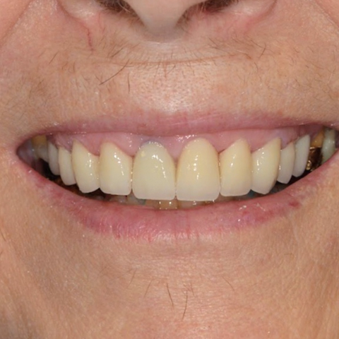 Healthy smile after dental treatment