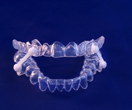 Sleep apnea oral appliance