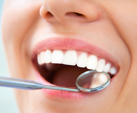 Closeup of smile after tooth-colored filling placement