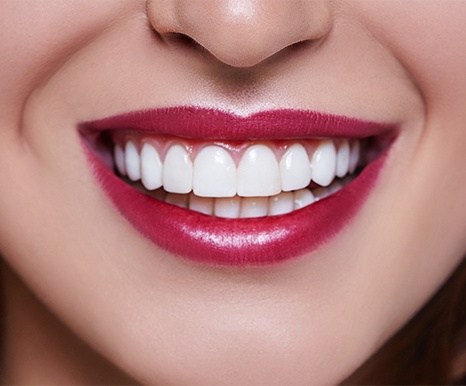 Closeup of smile after cosmetic crown lengthening