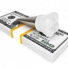dental implant lying on top of a stack of cash