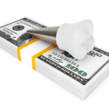 dental implant lying on top of a stack of cash