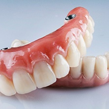 Implant dentures