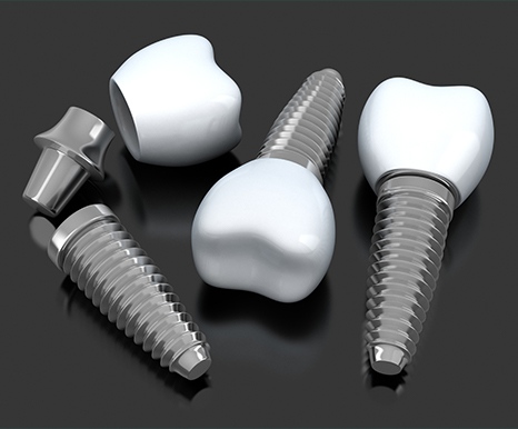 Three animated dental implants