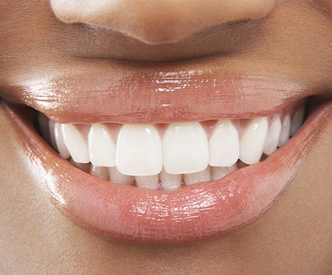 Closeup of healthy smile thanks to periodontal maintenance